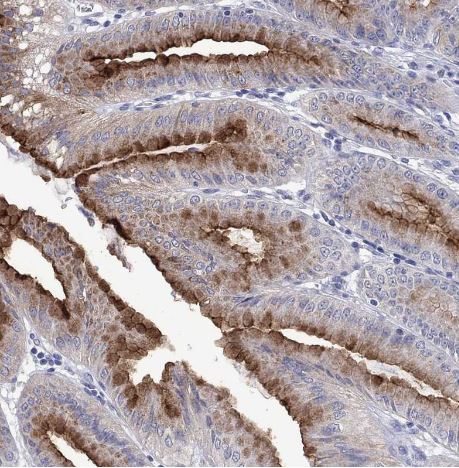 Fer-1-like protein 6 Antibody Fer-1-like protein 6 Antibody