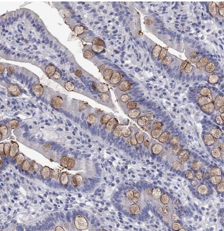 Fer-1-like protein 6 Antibody Fer-1-like protein 6 Antibody