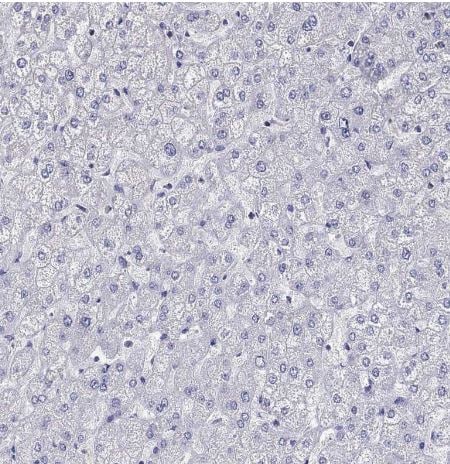 Fer-1-like protein 6 Antibody Fer-1-like protein 6 Antibody