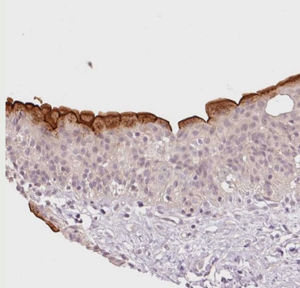 SLC29A3 Antibody - BSA Free