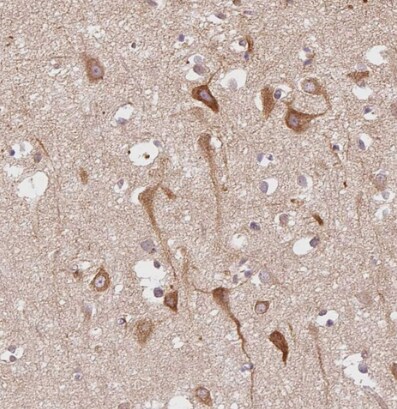 SLC29A3 Antibody - BSA Free