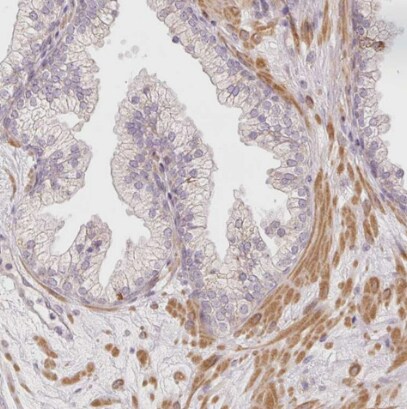 SLC29A3 Antibody - BSA Free