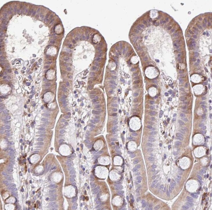 FIBCD1 Antibody - BSA Free