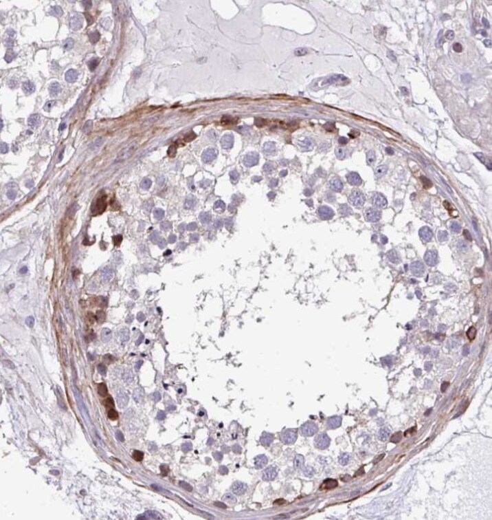 FIBCD1 Antibody - BSA Free