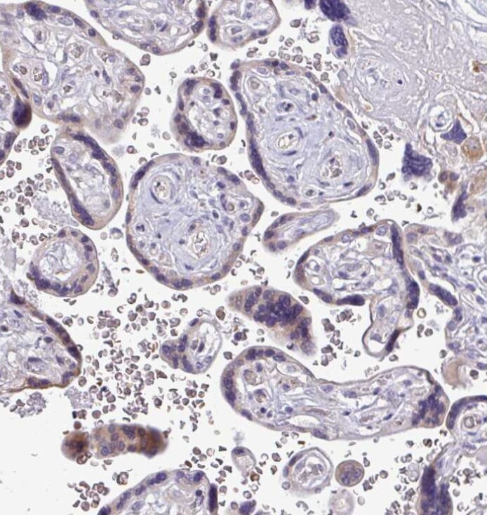 FIBCD1 Antibody - BSA Free