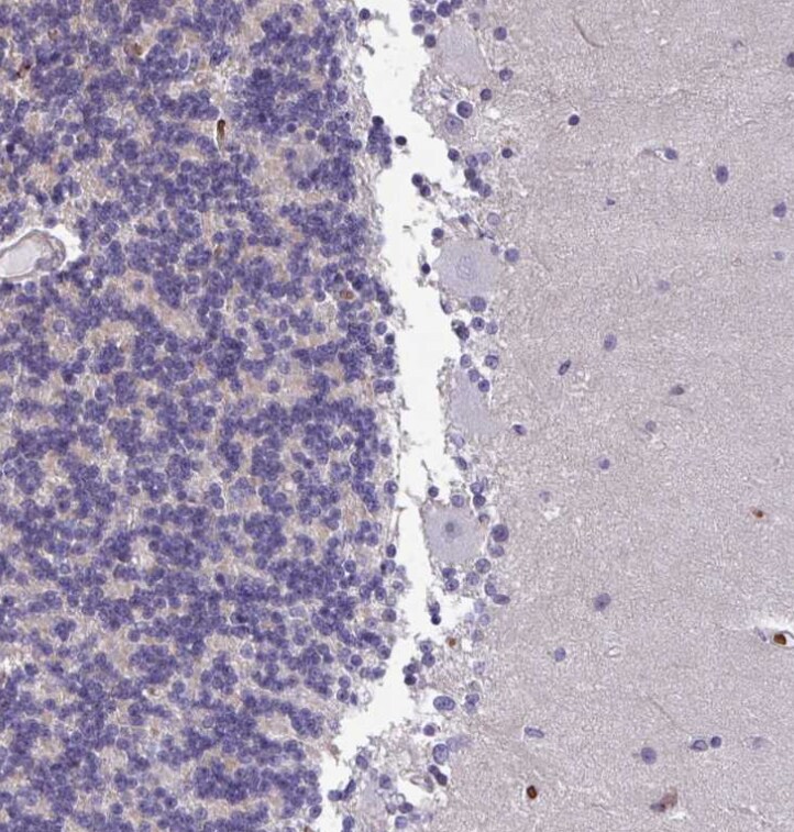 FIBCD1 Antibody - BSA Free