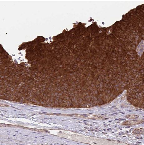 GLTP Antibody