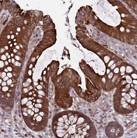 GLTP Antibody