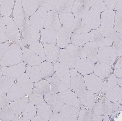CEMP1 Antibody