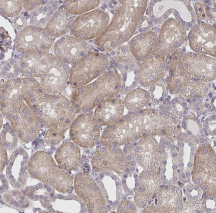 CEMP1 Antibody