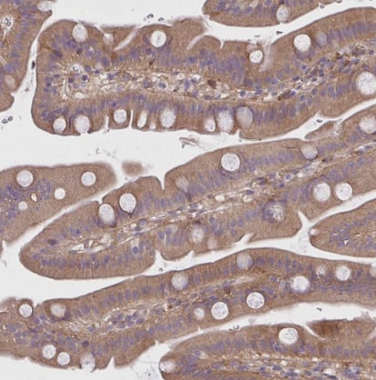CEMP1 Antibody