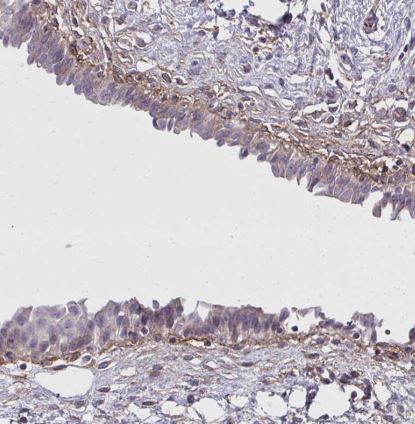 SLC14A1 Antibody