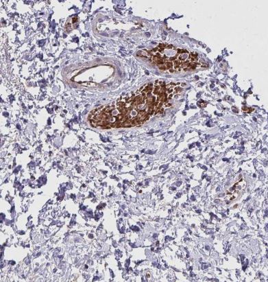 SLC14A1 Antibody