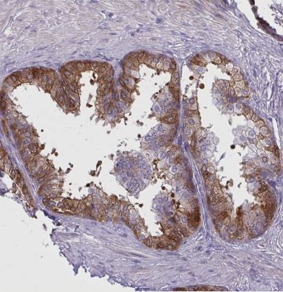 SLC14A1 Antibody