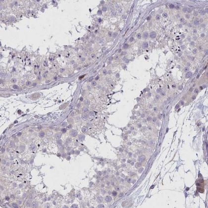 SLC14A1 Antibody