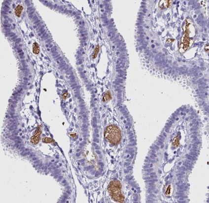RHBDL3 Antibody