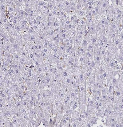 RHBDL3 Antibody