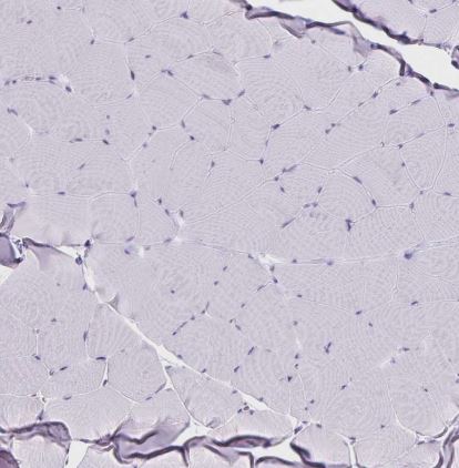 RHBDL3 Antibody