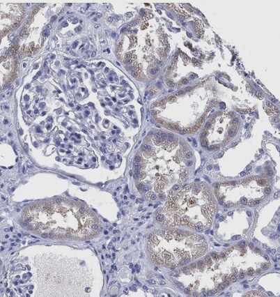 IYD Antibody