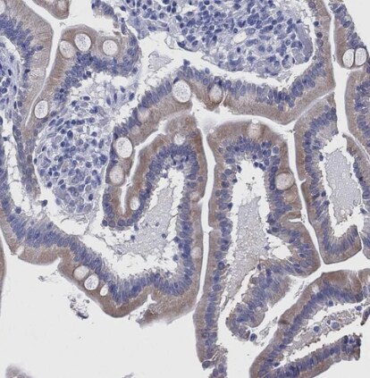 IYD Antibody
