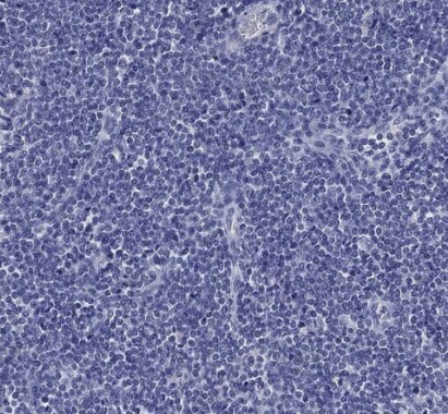 IYD Antibody