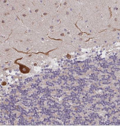 NAALADase-2/NAALAD2 Antibody