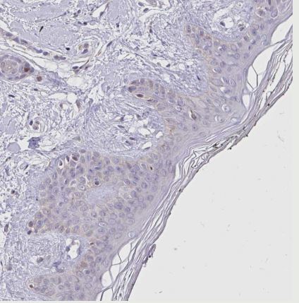 NAALADase-2/NAALAD2 Antibody