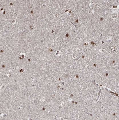 GTF3C6 Antibody