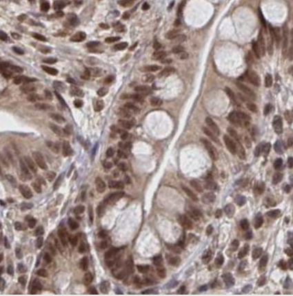 GTF3C6 Antibody