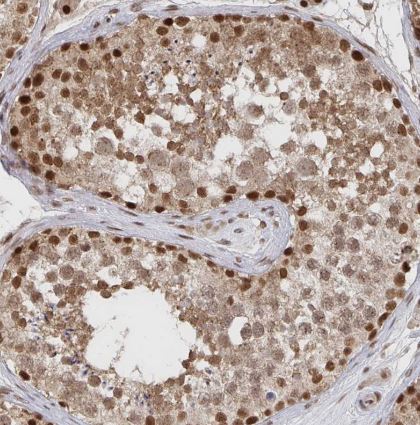 GTF3C6 Antibody