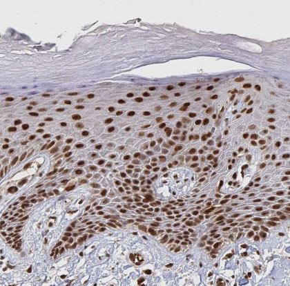 GTF3C6 Antibody