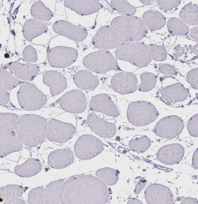 ULBP-3 Antibody - BSA Free