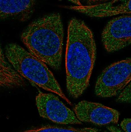 CNOT1 Antibody