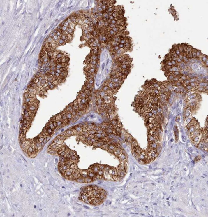 SRD5A1 Antibody - BSA Free