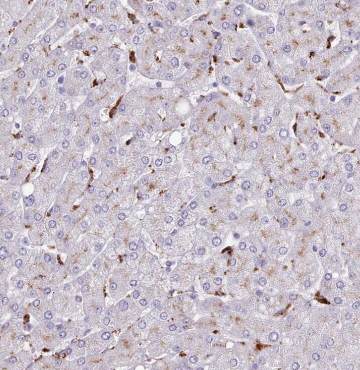 SRD5A1 Antibody - BSA Free