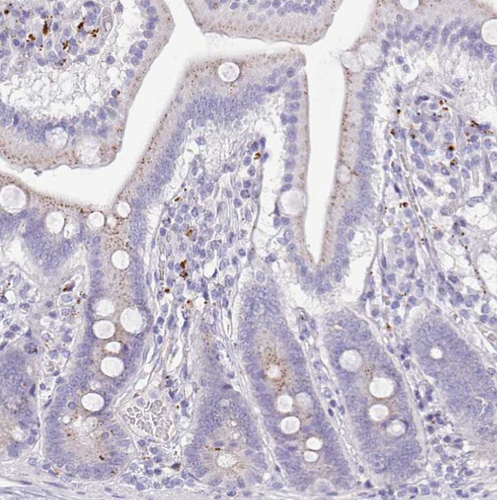 SRD5A1 Antibody - BSA Free