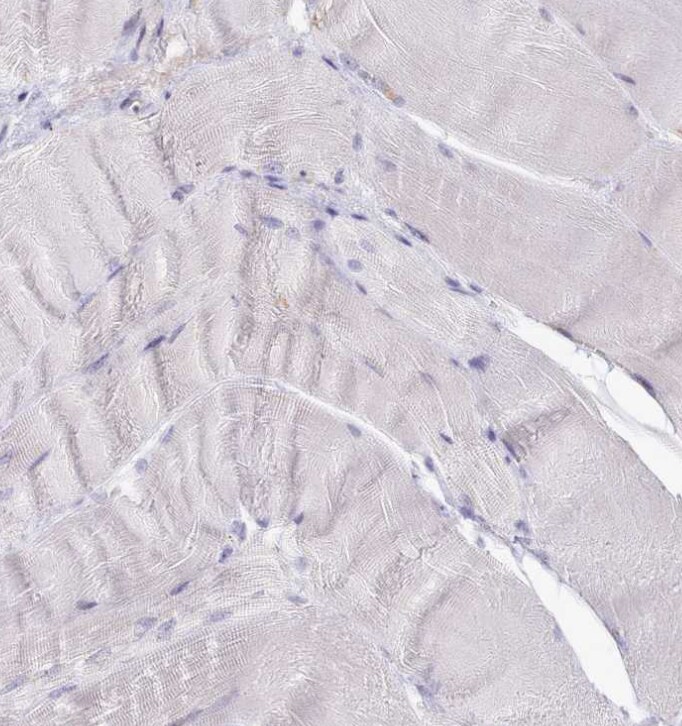 SRD5A1 Antibody - BSA Free