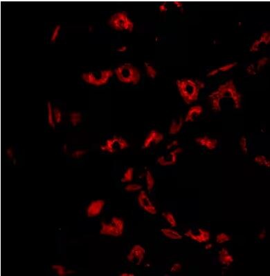 Hydrogen Potassium ATPase Beta Antibody Hydrogen Potassium ATPase Beta Antibody