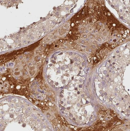 PGLYRP2/PGRP-L Antibody