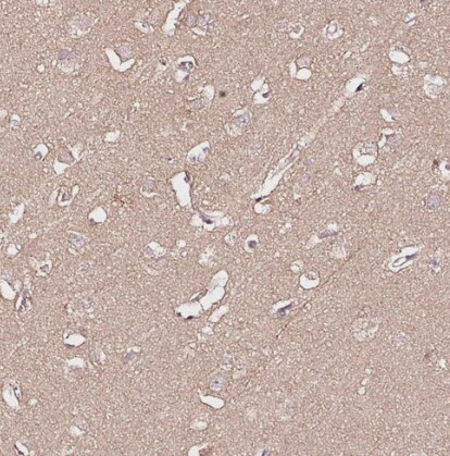 PGLYRP2/PGRP-L Antibody