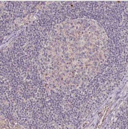 PGLYRP2/PGRP-L Antibody