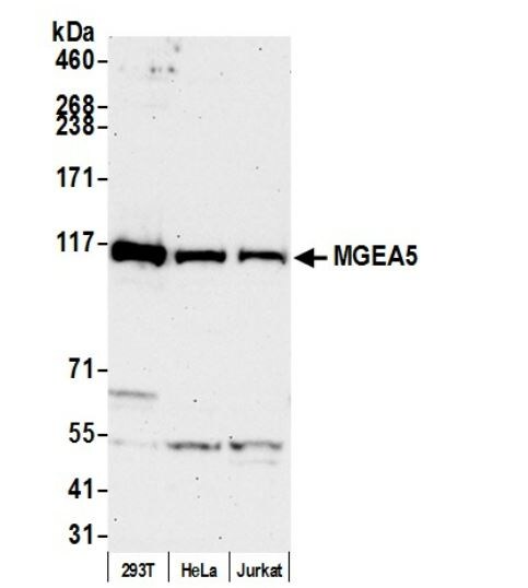 O-GlcNAcase/OGA/MGEA5 Antibody