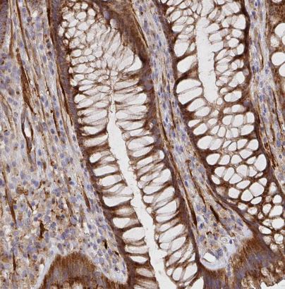 TM9SF4 Antibody