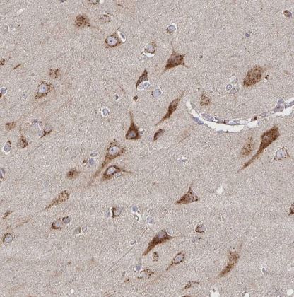 TM9SF4 Antibody