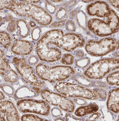 TM9SF4 Antibody