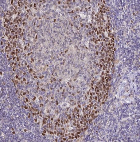 Timeless Antibody