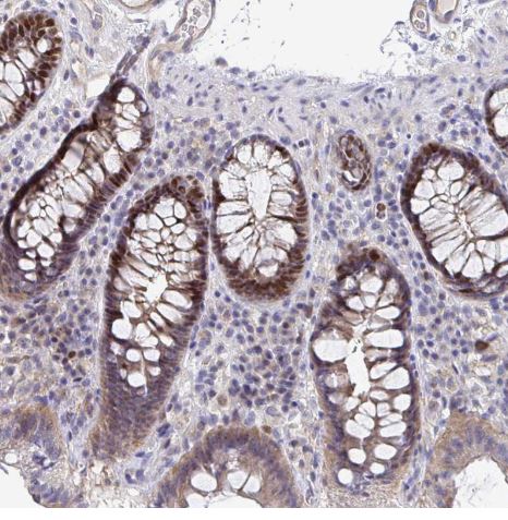 Timeless Antibody