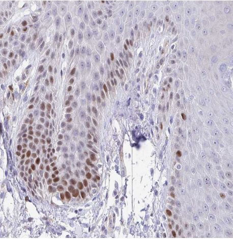 Timeless Antibody