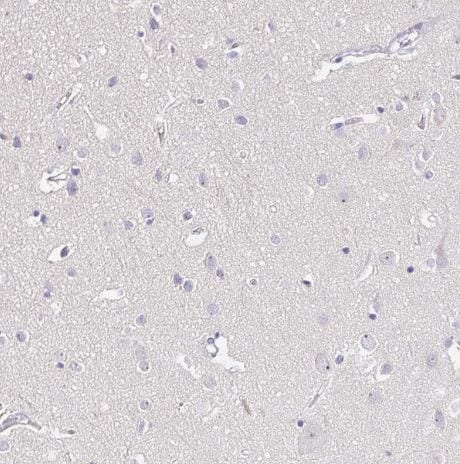 Timeless Antibody