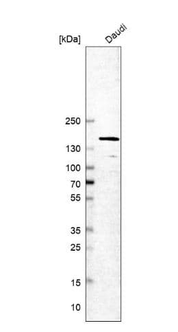 Timeless Antibody